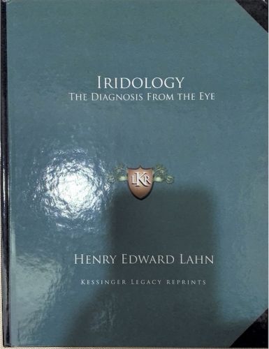 IRIDOLOGY-The diagnosis from the eye